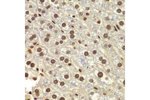 Immunohistochemistry of paraffin-embedded mouse liver using DDX5 antibody. (DDX5 antibody  (AA 1-614))