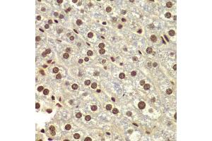 Immunohistochemistry of paraffin-embedded mouse liver using DDX5 antibody. (DDX5 antibody  (AA 1-614))