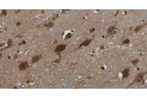 Immunohistochemistry of paraffin-embedded Human brain tissue using GLIPR1 Polyclonal Antibody at dilution 1:50 (GLIPR1 antibody)