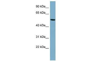 PRPH antibody used at 1 ug/ml to detect target protein. (Peripherin antibody  (Middle Region))