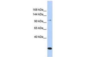Image no. 1 for anti-Transient Receptor Potential Cation Channel, Subfamily C, Member 6 (TRPC6) (N-Term) antibody (ABIN6744303) (TRPC6 antibody  (N-Term))