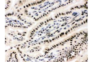 IHC analysis of RbAp48 using anti-RbAp48 antibody . (Retinoblastoma Binding Protein 4 antibody  (C-Term))
