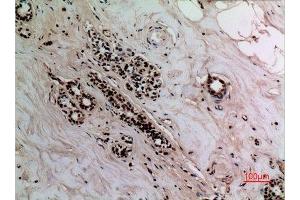 Immunohistochemistry (IHC) image for anti-Nuclear Factor-kB p65 (NFkBP65) (acLys314), (acLys315) antibody (ABIN3188030)