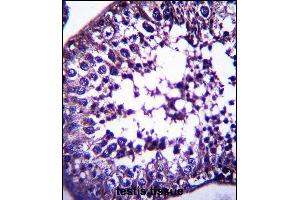 TSPYL5 Antibody (C-term) (ABIN657506 and ABIN2846530) immunohistochemistry analysis in formalin fixed and paraffin embedded human testis tissue followed by peroxidase conjugation of the secondary antibody and DAB staining. (TSPYL5 antibody  (C-Term))