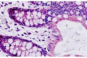 Human Small Intestine: Formalin-Fixed, Paraffin-Embedded (FFPE) (SAR1A antibody  (AA 128-158))