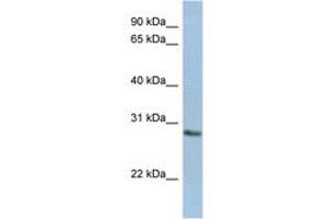 Image no. 1 for anti-N-Acetylneuraminic Acid Phosphatase (NANP) (AA 179-228) antibody (ABIN6743708)