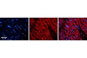 Rabbit Anti-ATG13 Antibody Catalog Number: ARP64383_P050 Formalin Fixed Paraffin Embedded Tissue: Human heart Tissue Observed Staining: Cytoplasmic Primary Antibody Concentration: 1:100 Other Working Concentrations: N/A Secondary Antibody: Donkey anti-Rabbit-Cy3 Secondary Antibody Concentration: 1:200 Magnification: 20X Exposure Time: 0. (ATG13 antibody  (N-Term))
