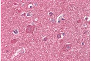 Anti-Reticulon 1/2 antibody IHC staining of human brain, cortex. (Reticulon 1 antibody  (AA 421-589))