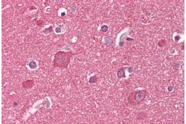 Reticulon 1 antibody  (AA 421-589)