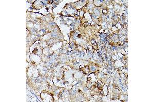 Immunohistochemistry (IHC) image for anti-CD81 (CD81) (AA 1-100) antibody (ABIN6138231)