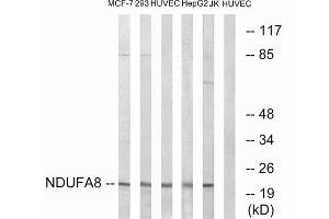 Western blot analysis of extracts from MCF-7 cells, 293 cells, HUVEC cells, HepG2 cells and Jurkat cells, using NDUFA8 antibody.