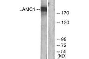 Western blot analysis of extracts from HuvEc cells, using LAMC1 Antibody.