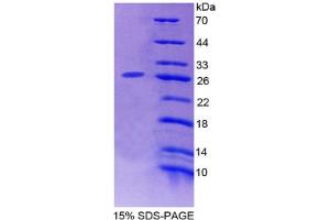 Image no. 1 for Protein Kinase D2 (PKD2) (AA 327-539) protein (His tag) (ABIN4988446)