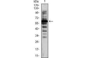 Western blot analysis using TIP60 mouse mAb against Hela (1) cell lysate.