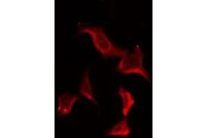 ABIN6278617 staining HuvEc by IF/ICC. (OR7C2 antibody  (Internal Region))