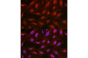 Immunofluorescence analysis of U2OS cells using [KO Validated]  Rabbit pAb (ABIN6133581 and ABIN6136917) at dilution of 1:100 (40x lens). (Annexin a1 antibody)