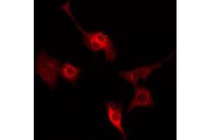 ABIN6269172 staining HeLa by IF/ICC. (SYN1 antibody  (N-Term))