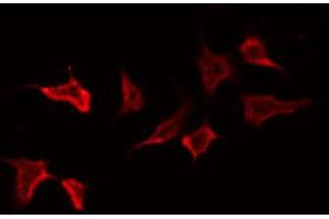 ABIN6272403 staining NIH-3T3 by IF/ICC. (PTPRN2 antibody  (Internal Region))
