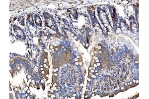 IHC analysis of TRIM16 using anti-TRIM16 antibody (ABIN7602226).
