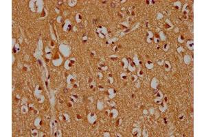 IHC image of ABIN7159994 diluted at 1:300 and staining in paraffin-embedded human brain tissue performed on a Leica BondTM system. (MAPK14 antibody  (AA 2-258))