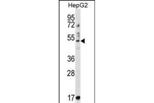 TRIM11 antibody  (C-Term)