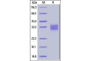 Biotinylated Mouse Fc gamma RIV, His,Avitag (BLI verified) on  under reducing (R) condition. (Fc gamma RIV / CD16-2 (AA 21-203) (Active) protein (His tag,AVI tag,Biotin))