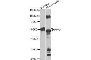 Western blot analysis of extracts of various cell lines, using PPAN Antibody (ABIN5975126) at 1/1000 dilution.