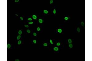 Immunofluorescent analysis of Hela cells using ABIN7139589 at dilution of 1:100 and Alexa Fluor 488-congugated AffiniPure Goat Anti-Rabbit IgG(H+L) (HIST1H1C antibody  (meLys118))