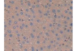 Detection of Hpt in Rat Liver Tissue using Polyclonal Antibody to Haptoglobin (Hpt) (Haptoglobin antibody  (AA 70-332))