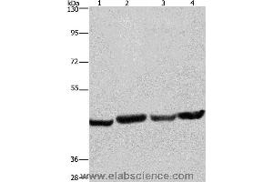 Western blot analysis of A549, Hela, PC3 and HepG2 cell, using RBMY1A1 Polyclonal Antibody at dilution of 1:360 (RBMY1A1 antibody)