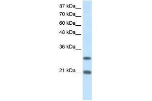 WB Suggested Anti-MSX2 Antibody Titration:  1.