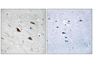 Immunohistochemistry (IHC) image for anti-Catenin, beta (CATNB) (pTyr489) antibody (ABIN1847545) (beta Catenin antibody  (pTyr489))