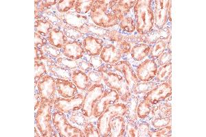 Immunohistochemistry (IHC) image for anti-Phosphogluconate Dehydrogenase (PGD) (AA 184-483) antibody (ABIN6145502)