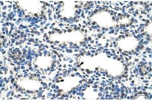 Human Lung; ARIH2 antibody - N-terminal region in Human Lung cells using Immunohistochemistry (ARIH2 antibody  (N-Term))