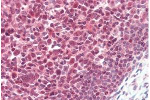 Immunohistochemistry (Paraffin-embedded Sections) (IHC (p)) image for anti-Poly (ADP-Ribose) Polymerase 1 (PARP1) (AA 396-412) antibody (ABIN462086)