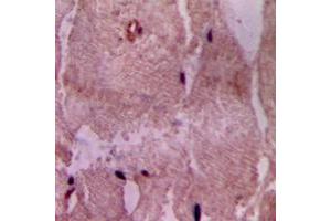 Immunohistochemical analysis of ACOT9 staining in human heart formalin fixed paraffin embedded tissue section. (ACOT9 antibody  (Center))