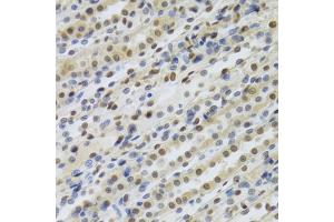 Immunohistochemistry of paraffin-embedded rat kidney using RBBP4 Antibody (ABIN5970697) at dilution of 1/100 (40x lens). (Retinoblastoma Binding Protein 4 antibody)
