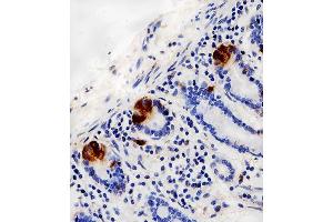 Immunohistochemical analysis of paraffin-embedded H. (LYZ antibody  (C-Term))