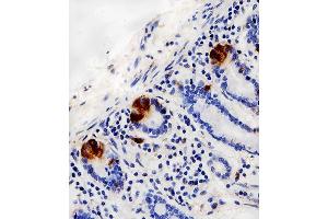 Immunohistochemical analysis of paraffin-embedded H. (LYZ antibody  (C-Term))