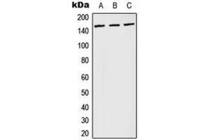 Western blot analysis of PLC gamma 1 (pY783) expression in Jurkat pervanadate-treated (A), NIH3T3 LPS-treated (B), PC12 H2O2-treated (C) whole cell lysates. (Phospholipase C gamma 1 antibody  (pTyr783))
