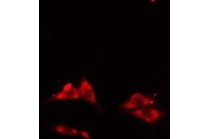 ABIN6275601 staining HepG2 cells by IF/ICC. (Sorting Nexin 3 antibody  (Internal Region))