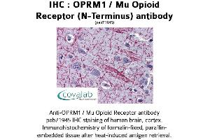 Image no. 2 for anti-Opioid Receptor, mu 1 (OPRM1) (N-Term) antibody (ABIN1737658) (Mu Opioid Receptor 1 antibody  (N-Term))