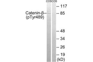 Western Blotting (WB) image for anti-Catenin, beta (CATNB) (pTyr489) antibody (ABIN1847544) (beta Catenin antibody  (pTyr489))
