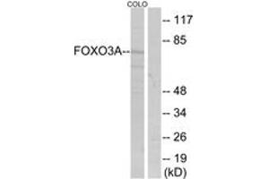 Western blot analysis of extracts from COLO205 cells, treated with serum, using FKHRL1 (Ab-253) Antibody. (FOXO3 antibody  (AA 220-269))