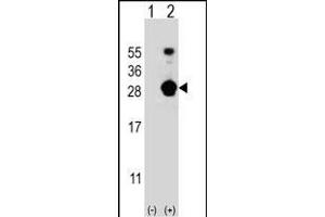 Western blot analysis of FKBP7 (arrow) using rabbit polyclonal FKBP7 Antibody (C-term) (ABIN656813 and ABIN2846027). (FKBP7 antibody  (C-Term))