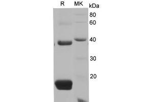 Western Blotting (WB) image for TIMP Metallopeptidase Inhibitor 1 (TIMP1) protein (His tag) (ABIN7320879) (TIMP1 Protein (His tag))