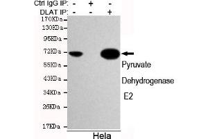 Immunoprecipitation analysis of Hela cell lysates using Pyruvate Dehydrogenase E2 mouse mAb. (CYB561 antibody)