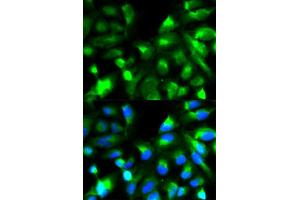 Immunofluorescence analysis of HeLa cell using SNAP25 antibody. (SNAP25 antibody  (AA 1-206))