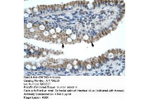 Human Intestine (ZNF683 antibody  (N-Term))