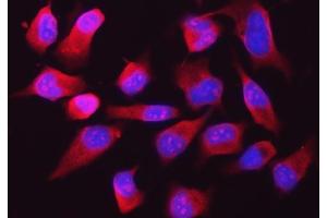 IF analysis of RPL32 using anti-RPL32 antibody (ABIN7602916).